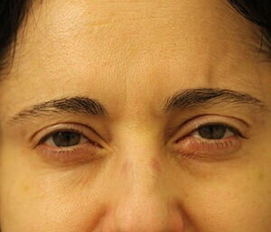 Case # 4 after photo