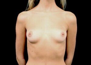 Case # 26 before photo