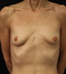 Case # 13 before photo