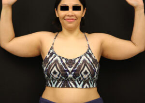 Case # 1 before photo