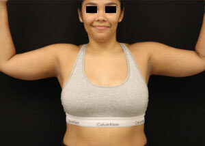 Case # 1 after photo