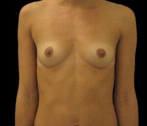 Case # 13 before photo