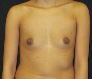 Case # 14 before photo