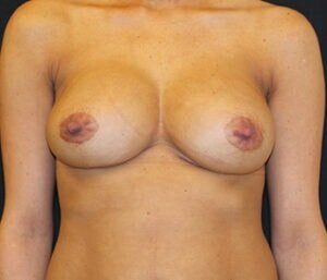 Case # 15 after photo