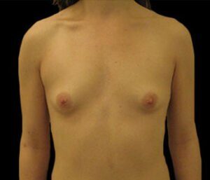 Case # 16 before photo