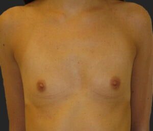 Case # 17 before photo