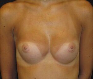 Case # 17 after photo