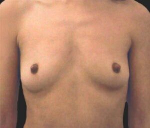 Case # 18 before photo