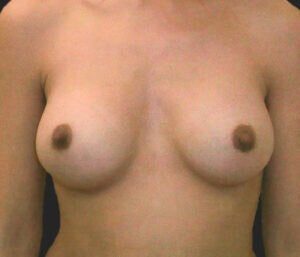 Case # 18 after photo