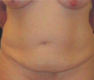 Case # 9 before photo