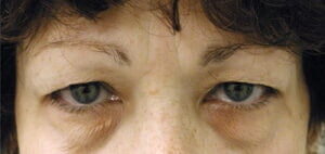 Case # 10 before photo