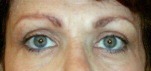 Case # 10 after photo