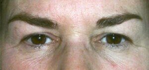 Case # 11 before photo