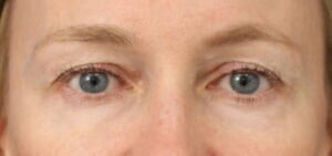 Case # 12 before photo