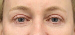 Case # 12 after photo