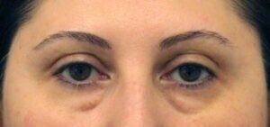 Case # 13 before photo