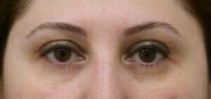 Case # 13 after photo