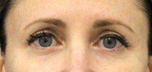 Case # 14 after photo