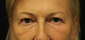 Case # 16 before photo