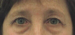 Case # 18 before photo