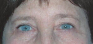 Case # 18 after photo