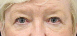 Case # 20 before photo