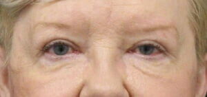 Case # 20 after photo