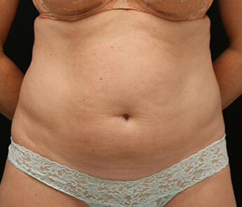 Case # 13 before photo