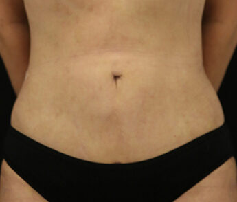 Case # 15 after photo