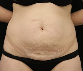 Case # 16 before photo