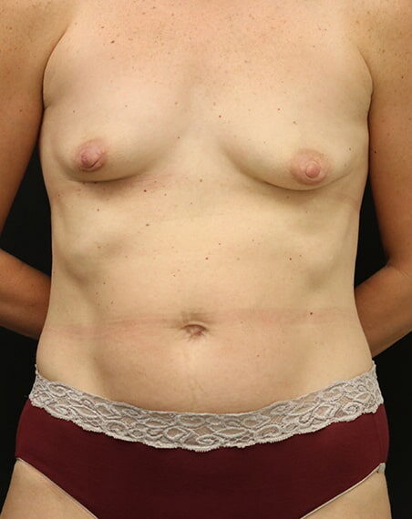 Case # 5 before photo