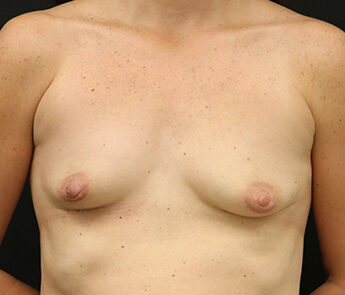 Case # 28 before photo