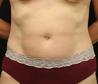 Case # 17 before photo