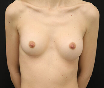 Case # 6 before photo