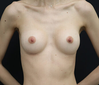 Case # 6 after photo