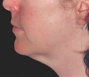 Case # 11 before photo