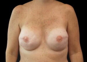 Case # 8 after photo