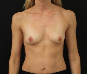 Case # 21 before photo