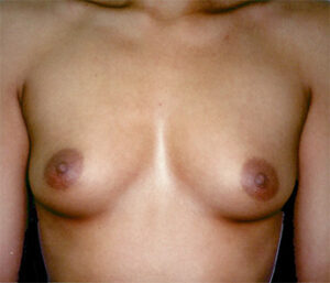 Case # 20 before photo