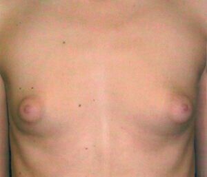 Case # 23 before photo