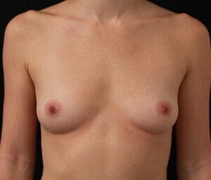 Case # 24 before photo