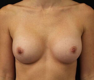 Case # 24 after photo