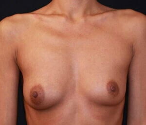 Case # 27 before photo