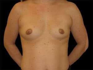 Case # 25 before photo