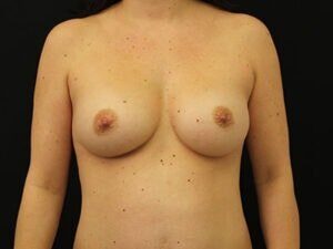 Case # 25 after photo