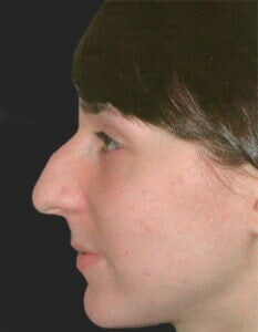 Case # 2 before photo