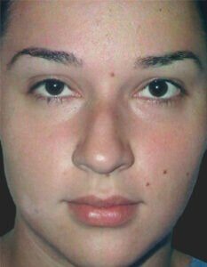 Case # 3 before photo