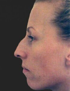 Case # 6 before photo