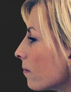 Case # 6 after photo