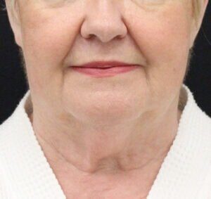 Case # 8 before photo